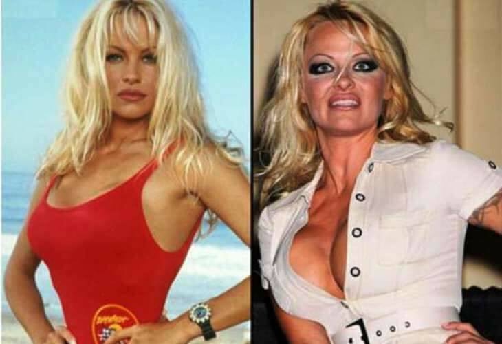 Pamela Anderson